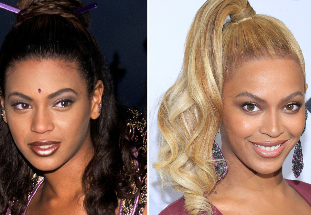 Beyonce Knowles Plastic Surgery With Before And After Photos