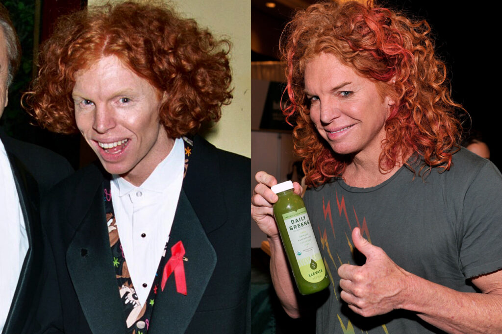 Carrot Top Plastic Surgery With Before And After Photos