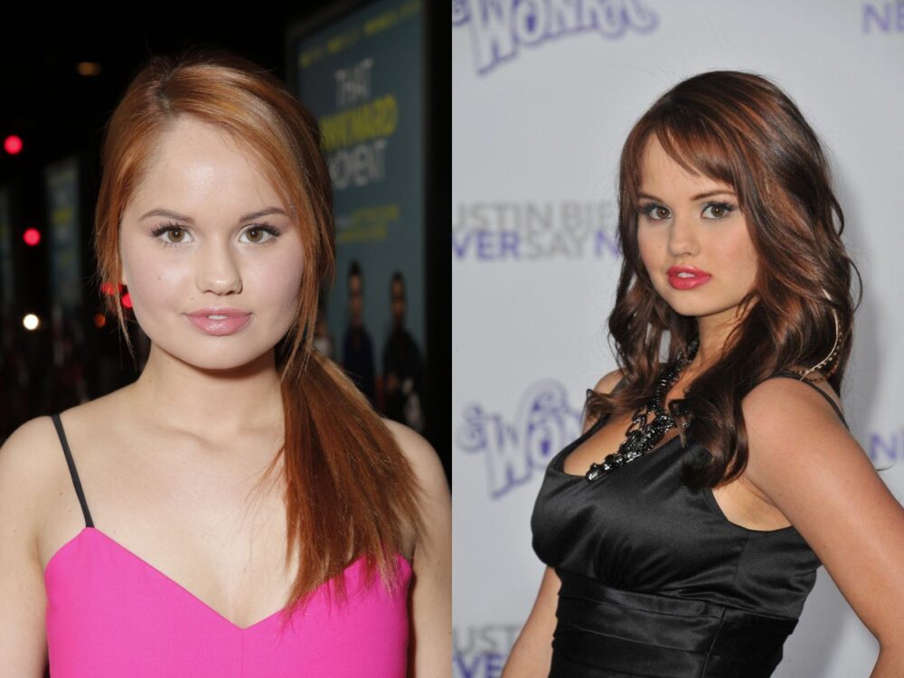 Debby Ryan Plastic Surgery - With Before And After Photos