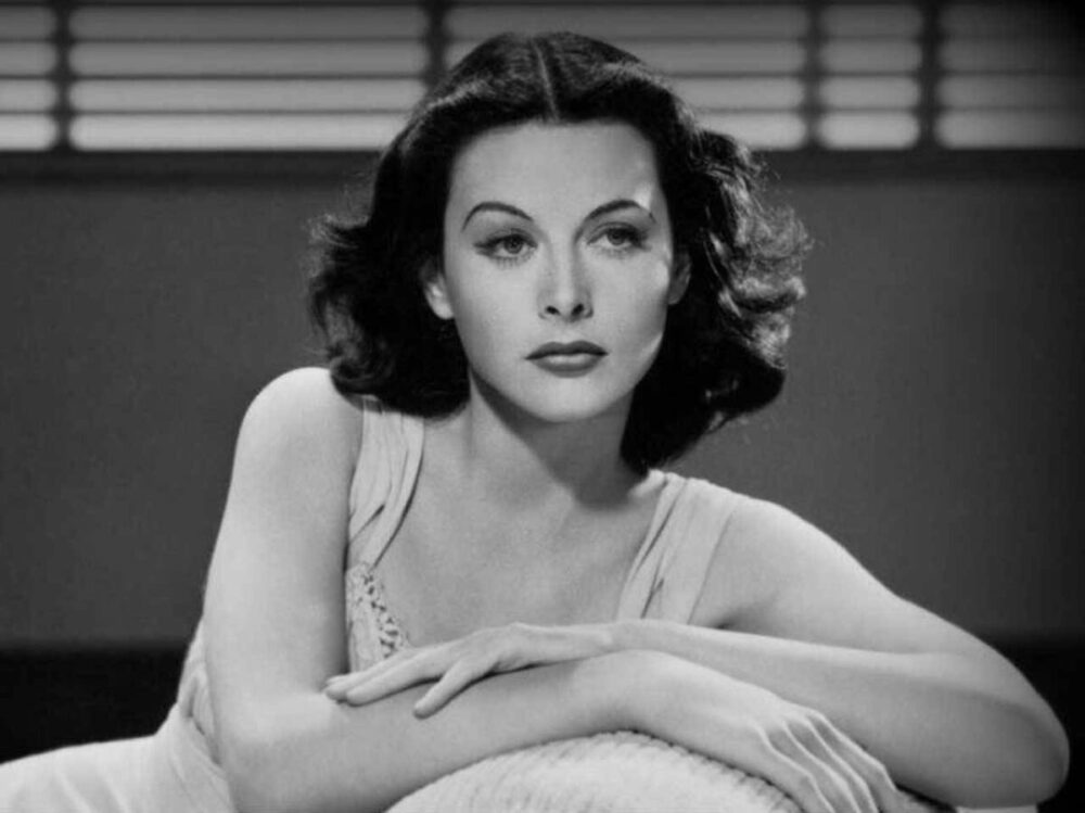 Hedy Lamarr Plastic Surgery - With Before And After Photos.