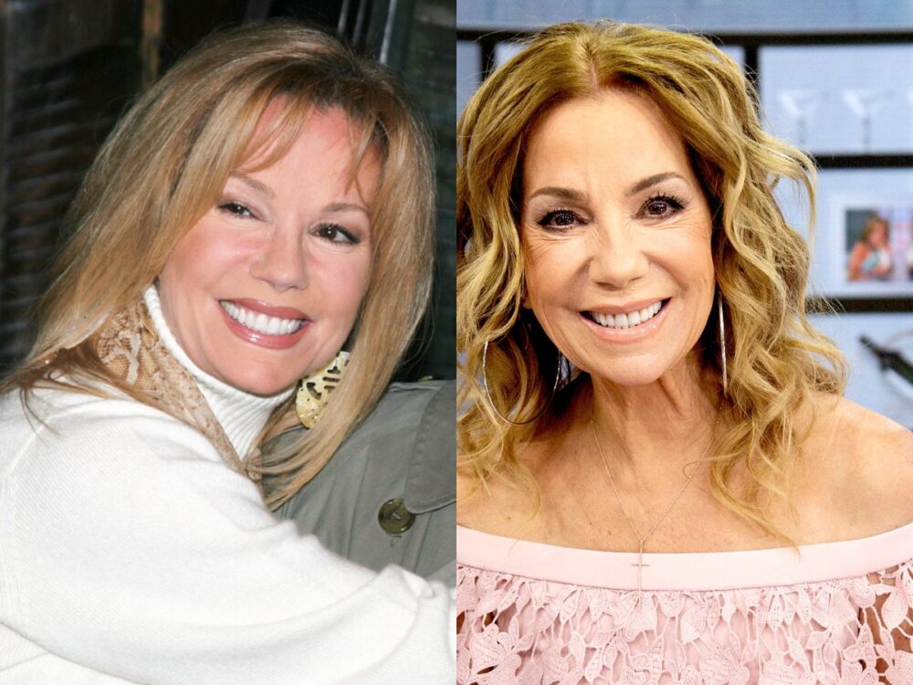 Kathie Lee Gifford Plastic Surgery - With Before And After Photos