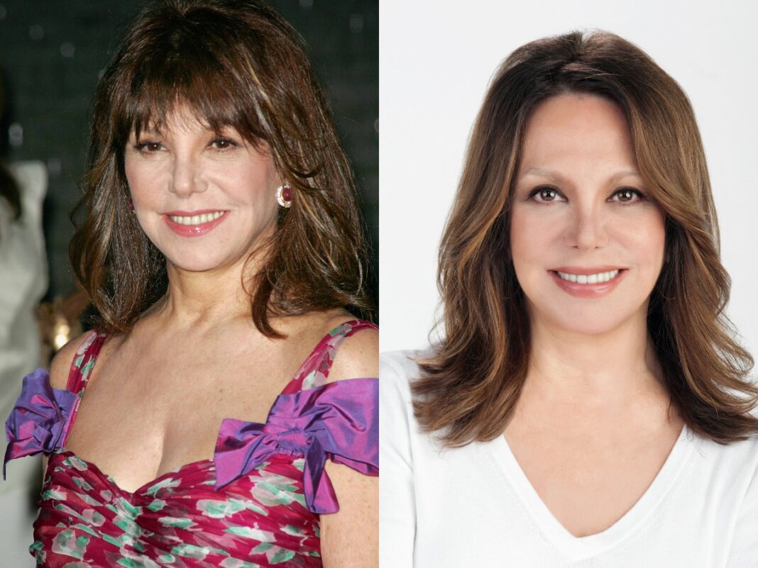 Marlo Thomas Plastic Surgery With Before And After Photos