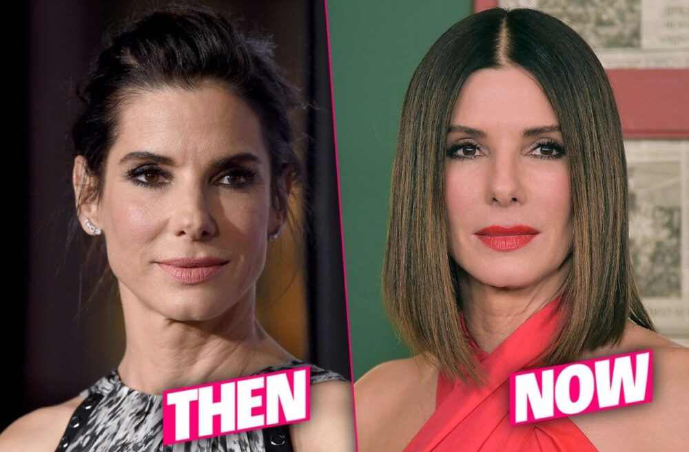 Sandra Bullock Plastic Surgery With Before And After Photos