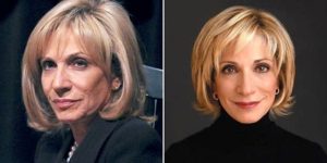 andrea mitchell facelift