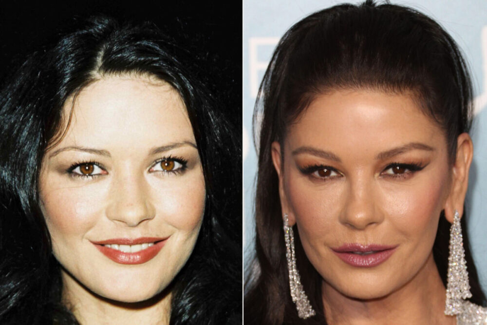 Catherine Zeta Jones Plastic Surgery - With Before And After Photos.