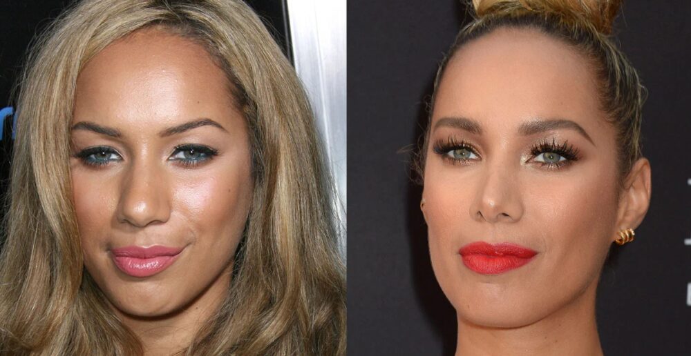 that would leave fans excited as it talks about Leona Lewis plastic surgery...
