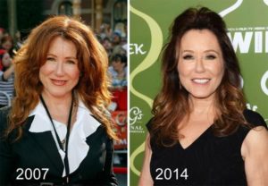 mary mcdonnell plastic surgery
