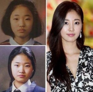 park min young facelift