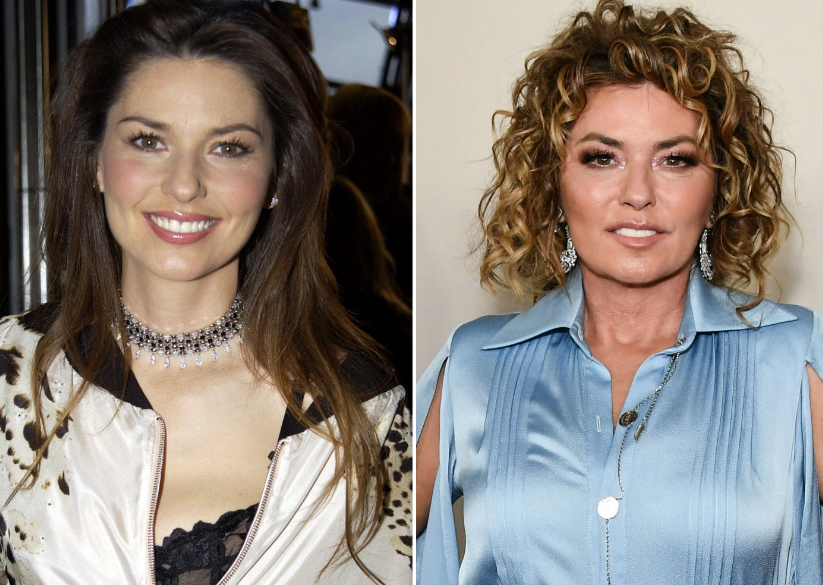 Shania Twain Plastic Surgery – With Before And After Photos