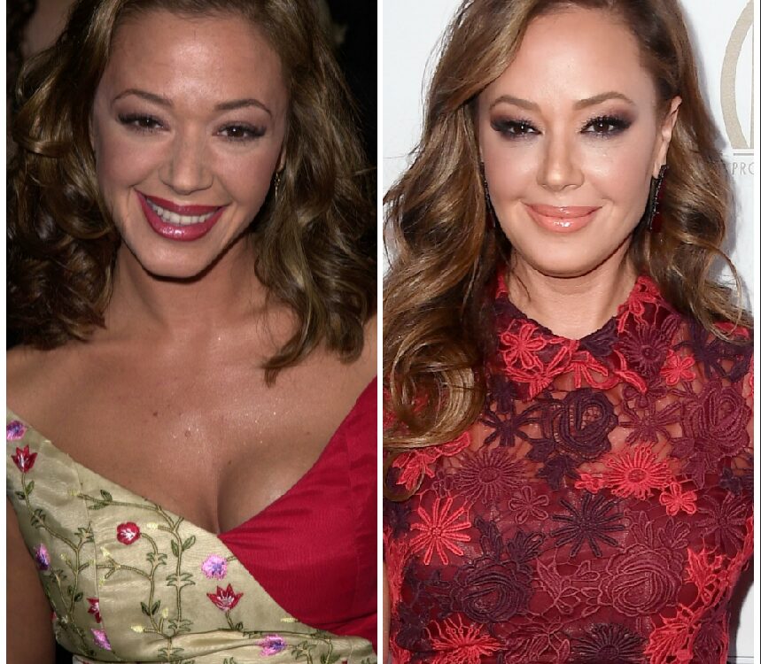 Leah Remini Plastic Surgery - With Before And After Photos.
