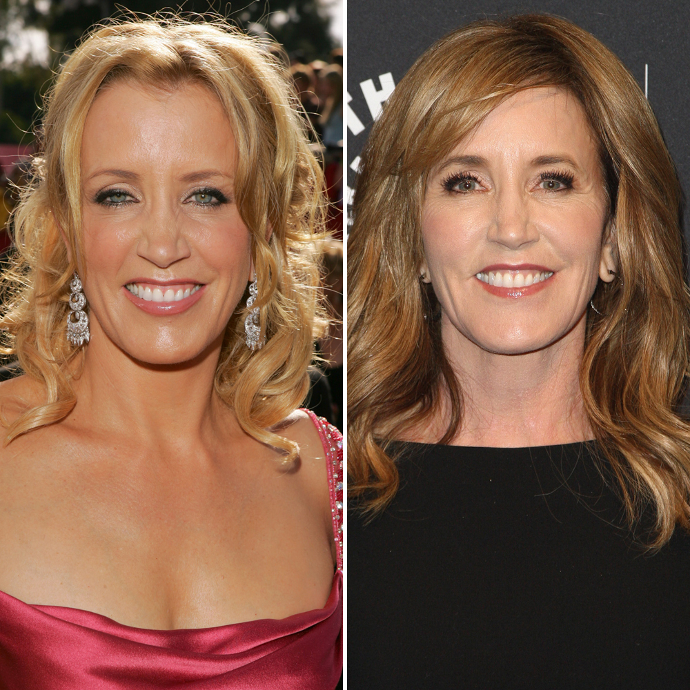 Felicity Huffman Plastic Surgery - With Before And After Photos.