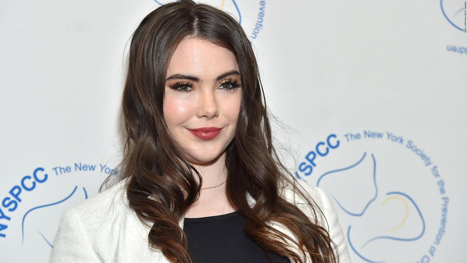 Mckayla Maroney Plastic Surgery With Before And After Photos